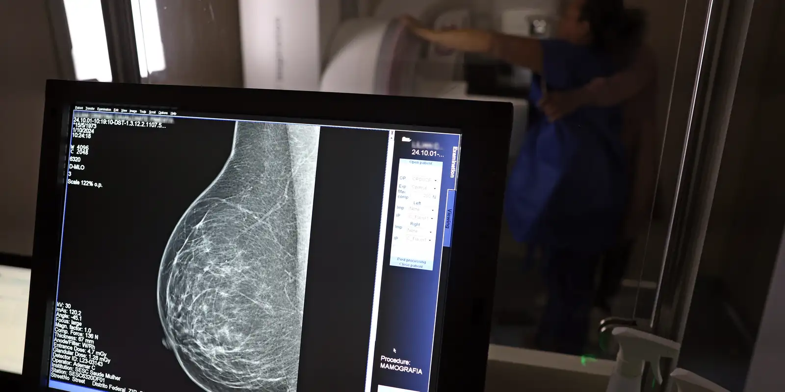 Planos de saúde passam a cobrir mamografia digital para todas as idades